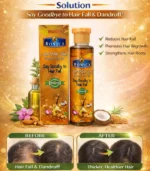 Ronica Anti Hair Fall Oil